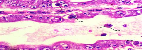 Photomicrograph Of Hepatopancreas Of Ehp Infected Litopenaeus Vannamei