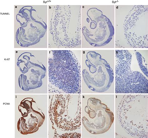 Immunohistochemical Analysis For Apoptosis And Cell Growth Ad Tunel