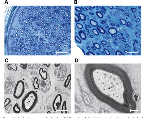 Figure 1 From Deficiency Of The E3 Ubiquitin Ligase TRIM2 In Early