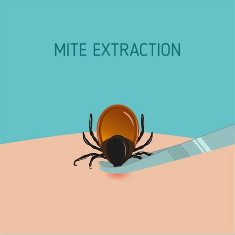 Premium Vector How To Remove Mite Insect Parasitic Encephalitis Tick