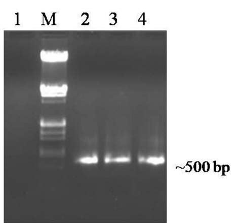 Agrose Gel Electrophoresis Of PCR Products Obtained From Zinnia Elegans