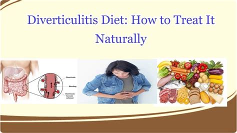 Diverticulitis Diet How To Treat It Naturally Youtube