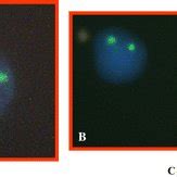 Detection of male microchimerism in bronchoalveolar lavage cells sorted ...