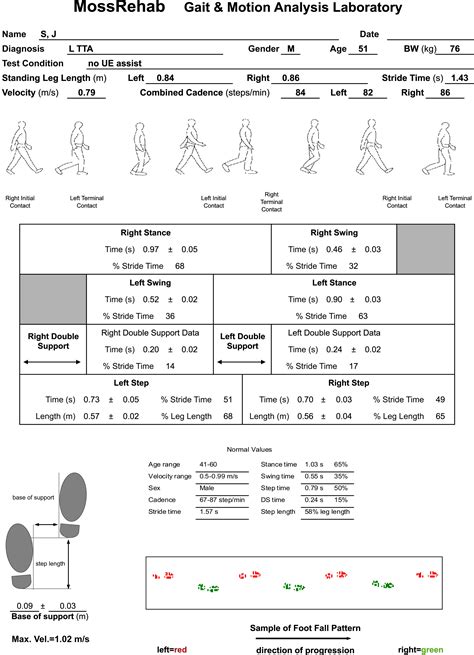 Gait Analysis In Lower Limb Amputation And Prosthetic Rehabilitation Physical Medicine And