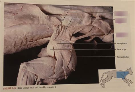 Appendicular Skeleton Lab Practicum Deep Neck And Back Muscles Diagram