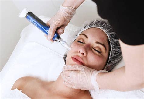 Book Microneedling Treatment In Melbourne Myskin Clinics