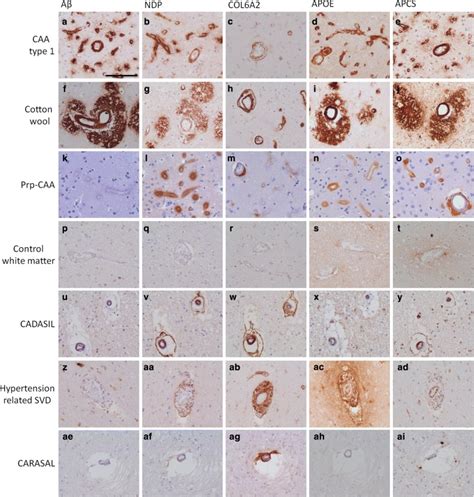 Proteomics Analysis Identifies New Markers Associated With Capillary