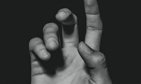 What S The Difference Between Trigger Finger Vs Dupuytrens Contracture