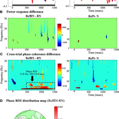 Time Frequency Responses And The Phase Coherence Difference