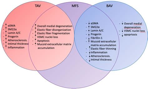 Frontiers Thoracic Aortopathy In Marfan Syndrome Overlaps With