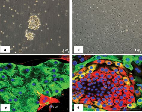 Primary Thyroid Cancer Cells Culture And Characterization A Thyroid