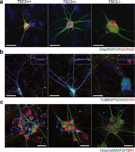 Characterization Of IPSC Derived Neurons IPSCs With Inducible NGN2