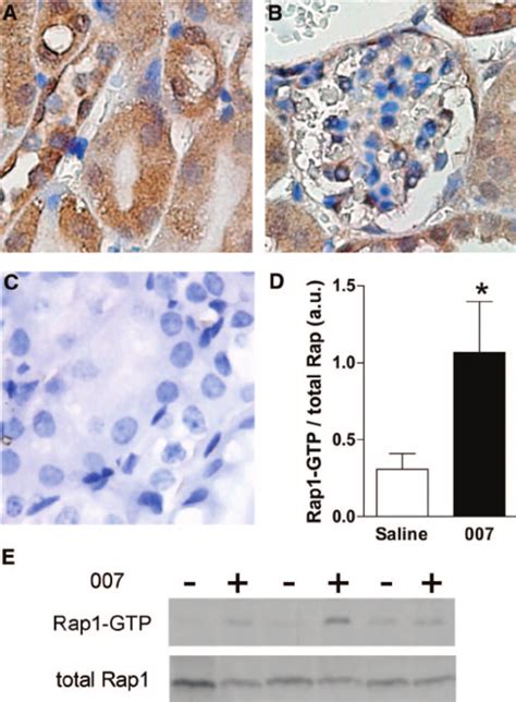 Epac Activation Mediates Focal Adhesion Stabilization During Hypoxia