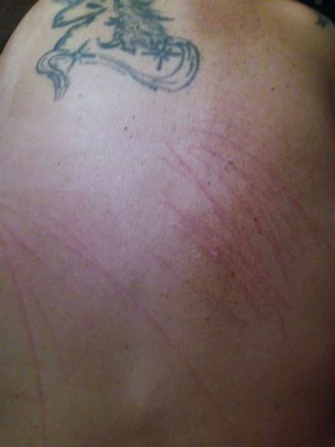 Mysterious Scratches On Back After Sleeping Youtube