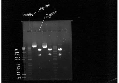 Solved DNA Agarose Gel Electrophoresis First Three Lane Chegg