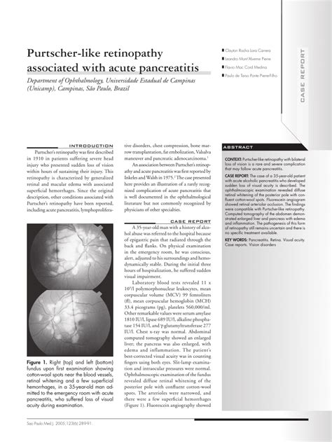 Pdf Purtscher Like Retinopathy Associated With Acute Pancreatitis