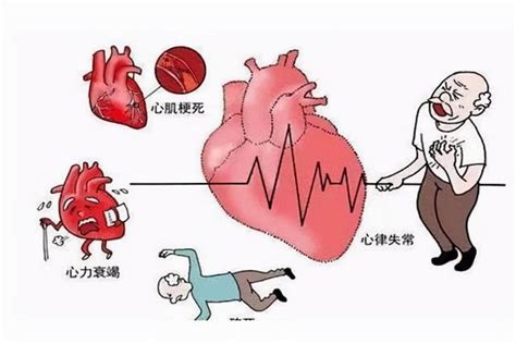 心臟病是「氣」出來的嗎？我們來聊一聊 每日頭條