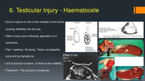 Common Urological Emergencies