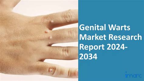 Ppt Genital Warts Market 2024 2034 Powerpoint Presentation Free