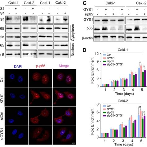 GYS1 activates the NF κB signaling pathway A Western blot revealed