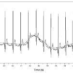 Removing Baseline Wandering A Original Waveform The Baseline Of The