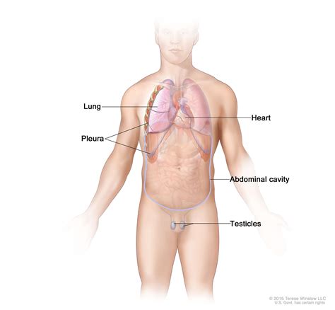 Malignant Mesothelioma—Patient Version - National Cancer Institute