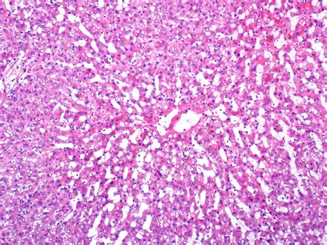 Pathology Outlines Anatomy And Histology