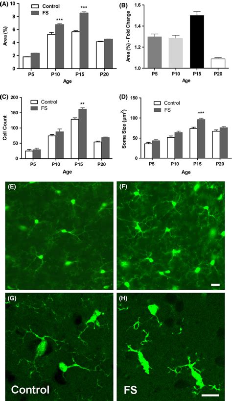 Microglial Activation In Developing Hippocampus H After Fs A