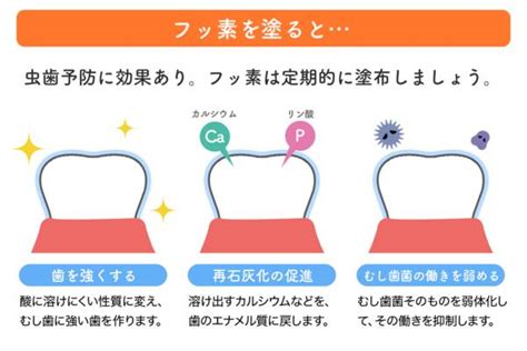 乳歯子どもの虫歯予防と治療 シーラント・フッ素 駒込駅前歯科クリニック・矯正歯科