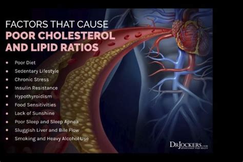 Cholesterol What Is It And What Are Healthy Levels ClikView Real