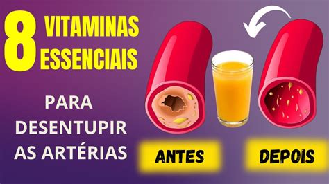 As Melhores Vitaminas Para Desobstruir As Art Rias Diga Adeus S