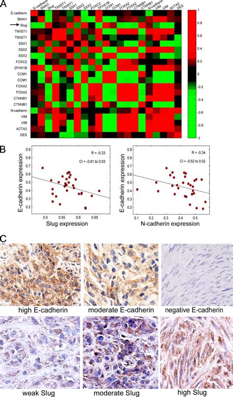 Inverse Correlation Of E Cadherin Expression With Slug A Correlation Download Scientific