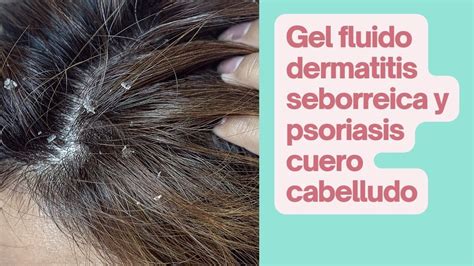 Gel Fluido Dermatitis Seborreica Y Psoriasis Cuero Cabelludo Youtube