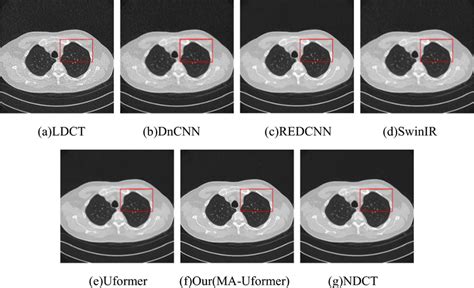 Denoising Results Of Low Dose Lung Ct Images Download Scientific Diagram