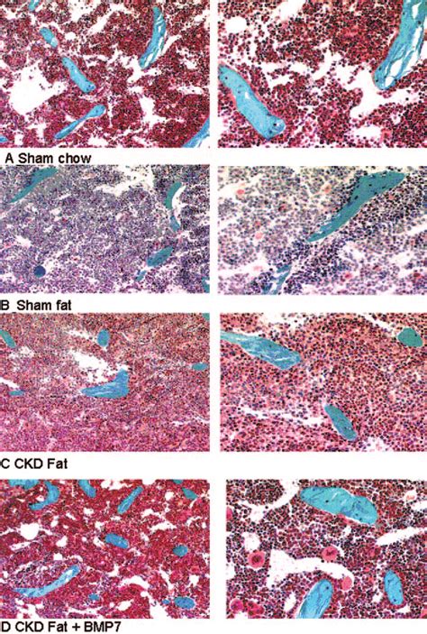 Goldner S Trichrome Stain Of Distal Femur Trabecular Bone