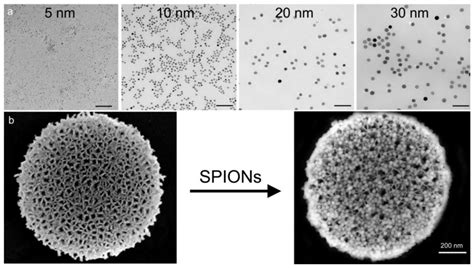 Superparamagnetic Iron Oxide Nanoparticles 超顺磁性氧化铁（spio）