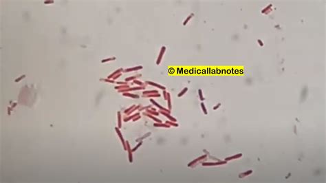 Citrobacter Freundii Introduction Morphology Pathogenicity Lab