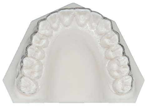 Essix Retainer - Protec Dental