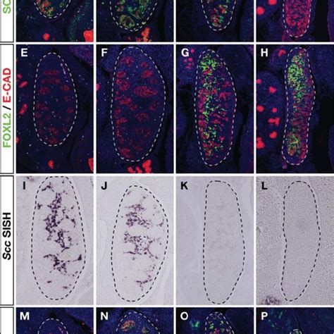 Markers Of Sexual Development In Fetal Gonads Of Wt1sox10 Transgenic