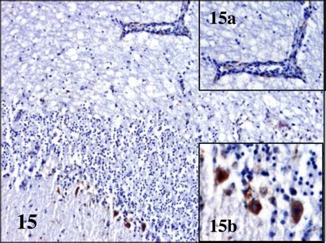 Viral Antigen Distribution In The Brain Of Bagv Infected Game Birds