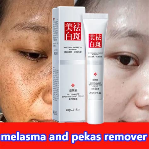 Whitening Freckle Cream Melasma And Pekas Remover Original Cream