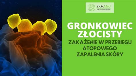 GRONKOWIEC ZŁOCISTY zakażenie u osób z ATOPOWYM ZAPALENIEM SKÓRY Jak