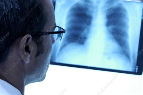 X Ray Diagnosis Stock Image M415 0502 Science Photo Library