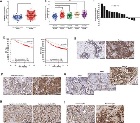 The Expression Of VASP In Breast Cancer Tissues Is Increased And