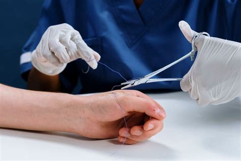 Top 5 Best Suture Scissors 2024 Guides By Rebatekey