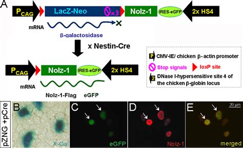 Figure From Ectopic Expression Of Nolz In Neural Progenitors