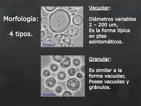 Blastocystis hominis