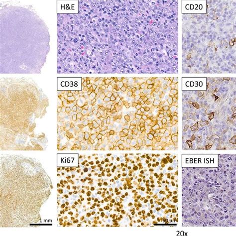 Hematoxylin And Eosin Hande Staining And Immunohistochemical Analysis