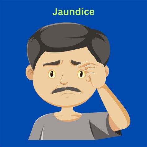 Jaundice Symptoms Causes Diagnosis Prevention Treatment