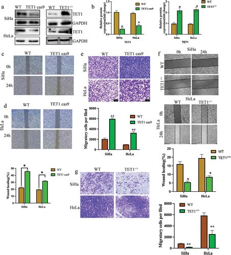 Full Article Tet1 Inhibits The Migration And Invasion Of Cervical Cancer Cells By Regulating